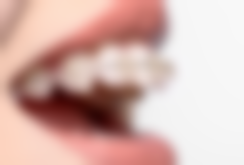 年龄大种植牙利和弊分别是什么？