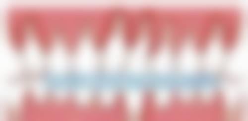 三、裴珠英医生眼部整形技术水平高