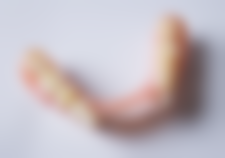 香港 格倫菲爾口腔討論區：網友真實实例大公開