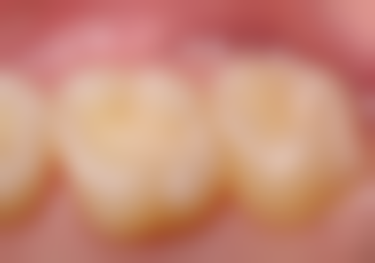 香港 拱北口岸牙科的营业时间：边间诊所更啱你？