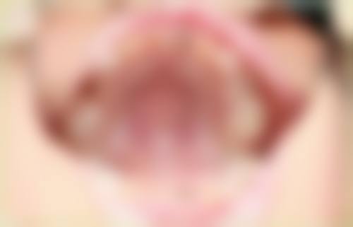 香港 蛀牙要掛哪一科？ 適合邊類人群