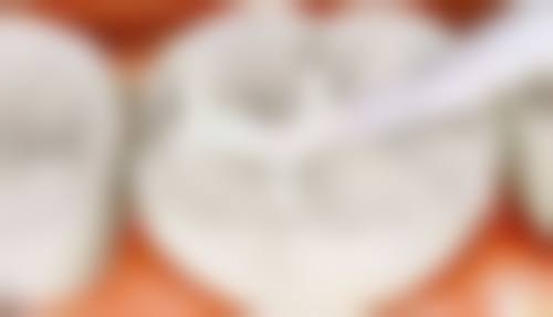 2026珠海拱北牙科精选3间！正畸/种植/牙周炎都掂