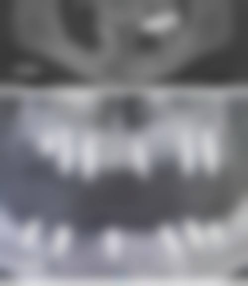 拓展延伸：香港人过拱北整牙必知！项目真相 + 避坑指南