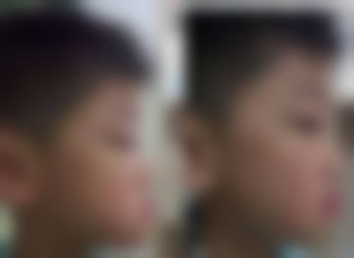 香港 珠海拱北牙科哪家好一点 价钱范围（HKD）