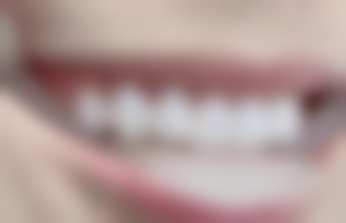 香港 澳门看牙贵吗现在 适合边类人群？——三类人建议留澳门，两类人必冲珠海！