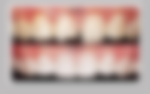 三、南甫庚医生技术水平高