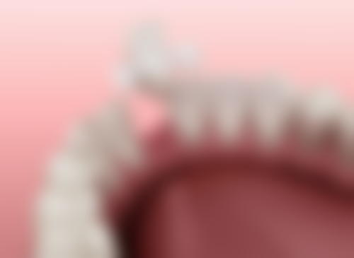 六、太仓达芬奇吾悦口腔诊所口腔项目价格参考