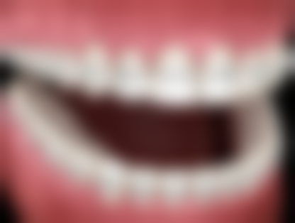 山东弗莱堡口腔医院正规可靠吗?