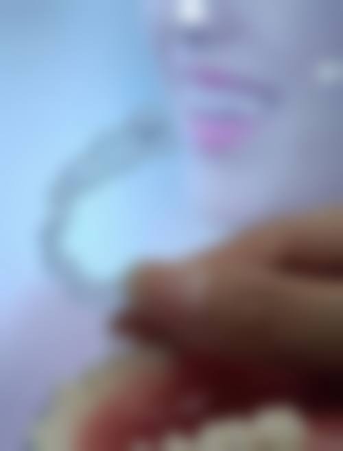 拓展延伸：澳门睇牙常见疑问+术前术后避坑指南