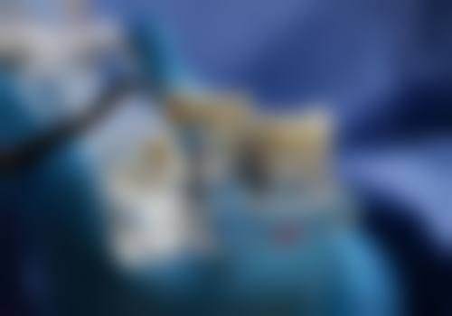 理性提醒：微創植牙香港 安心第一，唔好貪平！