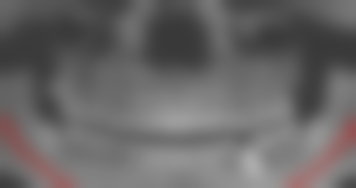 香港 微創植牙香港 真實體驗：3個姊妹嘅分享！