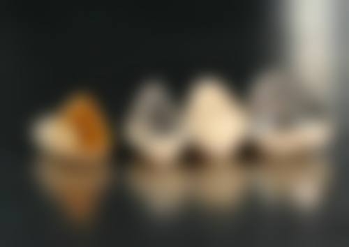 香港大睦vs深圳口岸整牙：價錢差幾多？有冇伏？