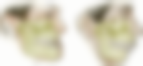 香港人深圳睇牙交通攻略：邊個口岸去格倫菲爾更方便？