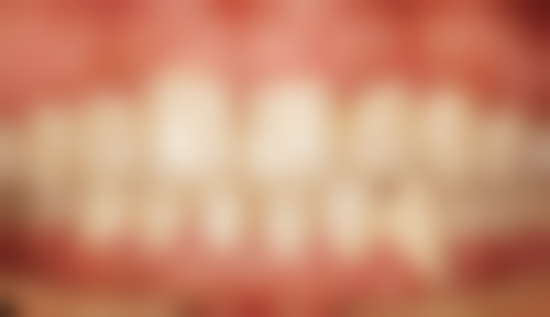 九、有关安阳北关添悦口腔门诊部爱尔创全瓷冠的问答