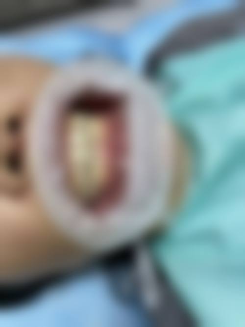 香港 澳门哪里有牙医诊所 价钱范围(HKD)?香港vs澳门vs珠海拱北对比