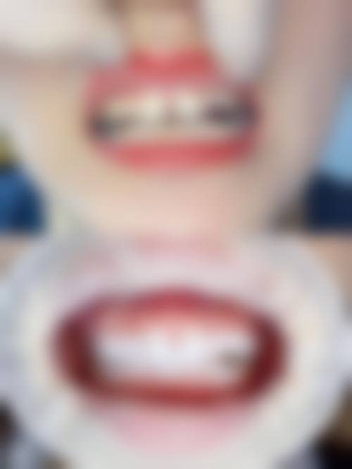 在决定是否选择瑞士sic种植体前，普通用户更容易忽略的关键评估点