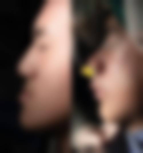 香港 香港大學深圳醫院牙科好唔好 關鍵選擇點：安心、位置、服務缺一不可