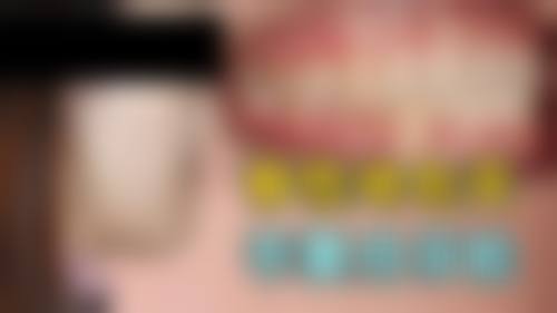 香港 香港大學深圳醫院牙科好唔好 適合邊類人群？返工媽咪/長者/正畸青年都啱