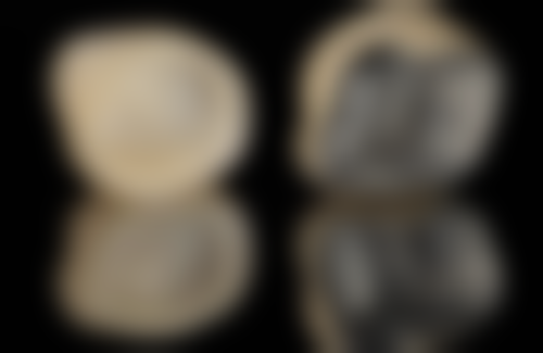 香港 澳門牙齒痛的藥有哪些 適合邊類人群