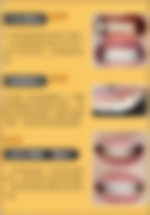 四、西安德美口腔（长乐分院）正规靠谱吗