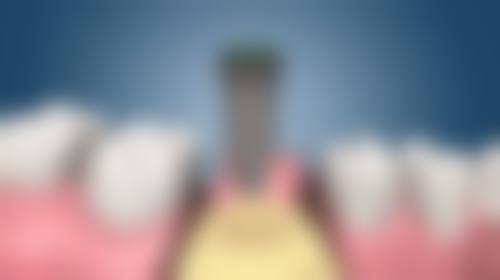 香港良心牙醫推薦 適合邊類人群