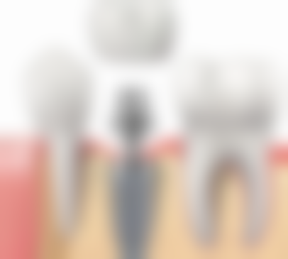 洗牙後護理貼士：香港姊妹必知！