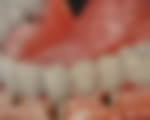 澳门种植牙边间好？南湾/氹仔/皇朝区诊所推荐