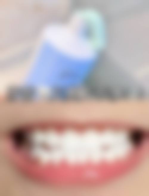 牙齿美白用什么牙膏成效好之潘泊草美白牙膏