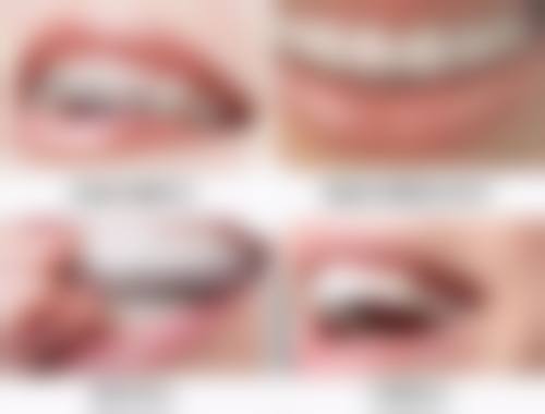 深圳牙科醫保報銷比例：港澳居民可唔可以用？