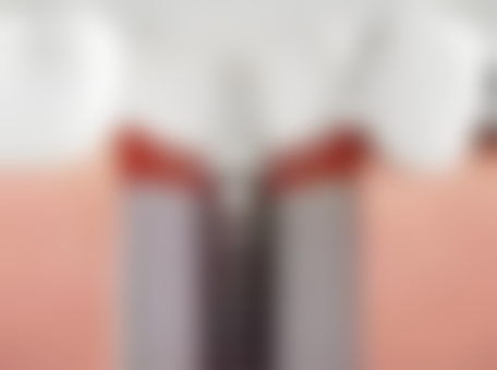 深圳牙科收費項目真相：港澳姊妹更關心3個問題