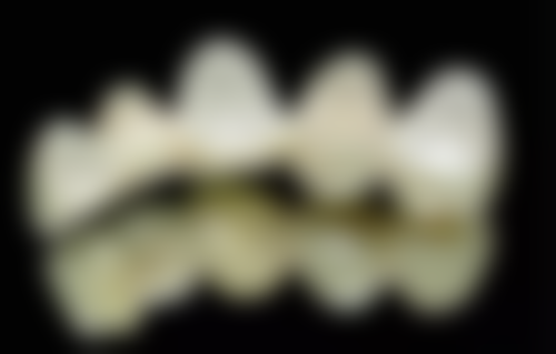 深圳牙科醫院排名 top10 熱門機構逐個評：格伦菲尔/麦芽/正夫邊間更啱你？