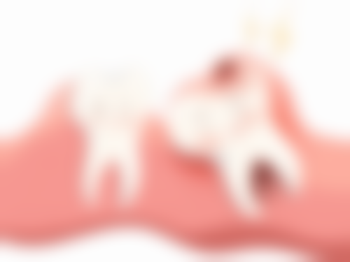 深圳牙科項目真相：即刻種牙真係當日食飯？隱形矯正要帶幾耐？