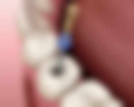 四、裴珠英医生做手术价格