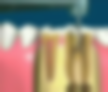 拱北睇牙术前术后避坑指南：澳门街坊必知！