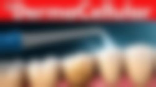 澳門看牙科醫院多少錢？2026珠海最新價目表曝光種牙1880元起省70%