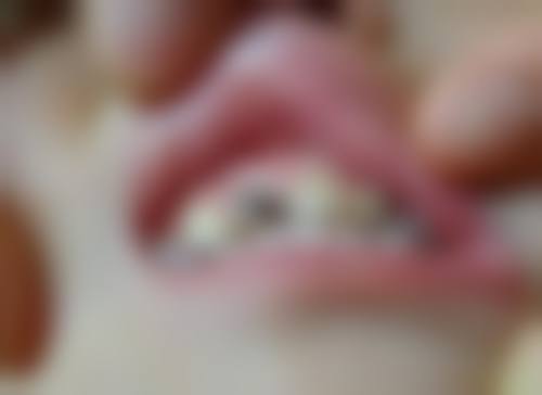 拓展延伸：種牙項目真相 + 關鍵選擇點