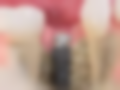 全口植牙項目真相：香港姊妹更關心3個問題