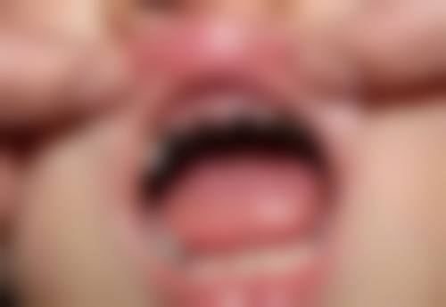 澳門矯正牙齒的醫院：揀珠海六和口腔有咩好處？