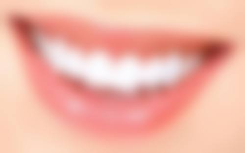苏州吴江美奥口腔医院患者常见问题解答（精选 ）