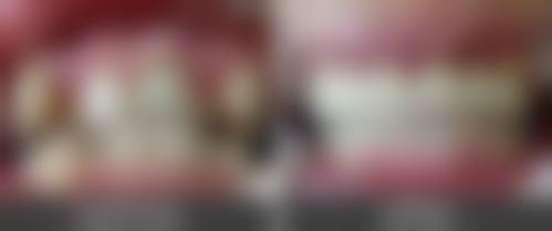 西安西美口腔门诊部口碑如何