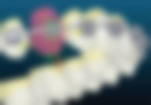 2、种植牙核心技术优势