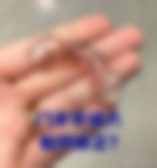 七、广东珠海尚德口腔种植牙技术怎么样