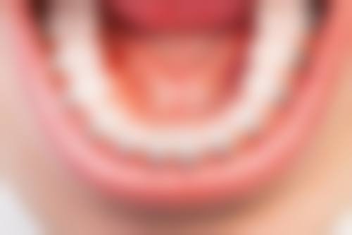 六、Lava牙冠的术后成效及修复情况