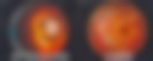 五、哈尔滨新梅眼科门诊部重点特色诊疗项目