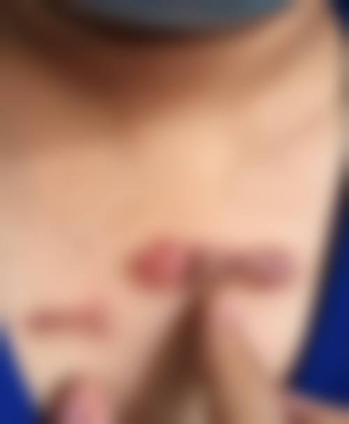 哈尔馥露医疗美容门诊部是正规医院吗?