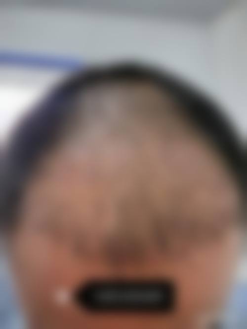 哈尔滨优漾医疗美容门诊部价格表/收费标准一览