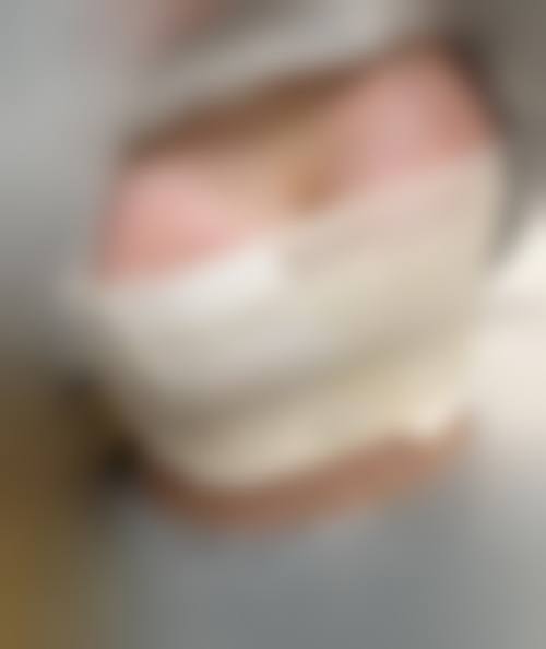 哈尔滨优漾医疗美容门诊部患者常见问题解答（精选）