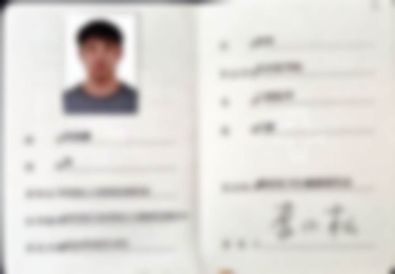 三、岳阳牙歪歪口腔核心技术支撑，义齿修复效率高又精细