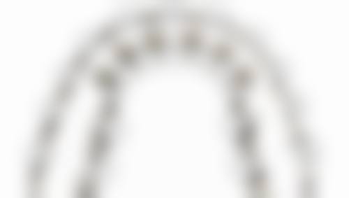 六、牙齿美白贴面与冷光美白的对比