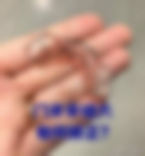 七、如何降低牙齿美白贴面对牙齿的伤害